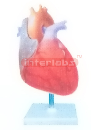 INCREASE IN MYOCARDIAL WALL TENSION MODEL